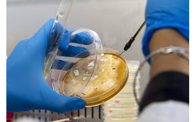 Immagine: FEM Laboratorio Diagnostica Fitopatologica 3666