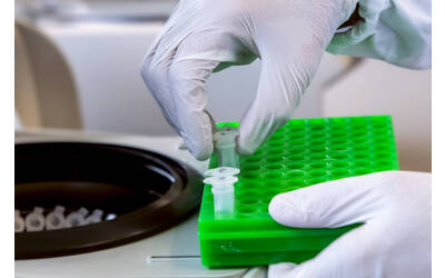 Immagine: FEM Laboratorio Diagnostica Fitopatologica 3764-02