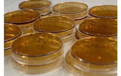 Immagine: FEM microbiologia 0872-02