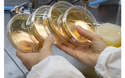 Immagine: FEM microbiologia 0941